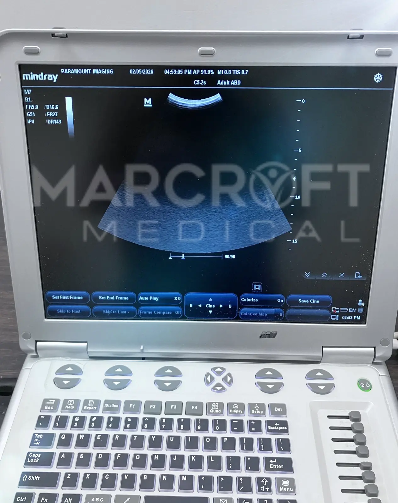 Mindray-M7-Portable-Ultrasound-for-sale-17