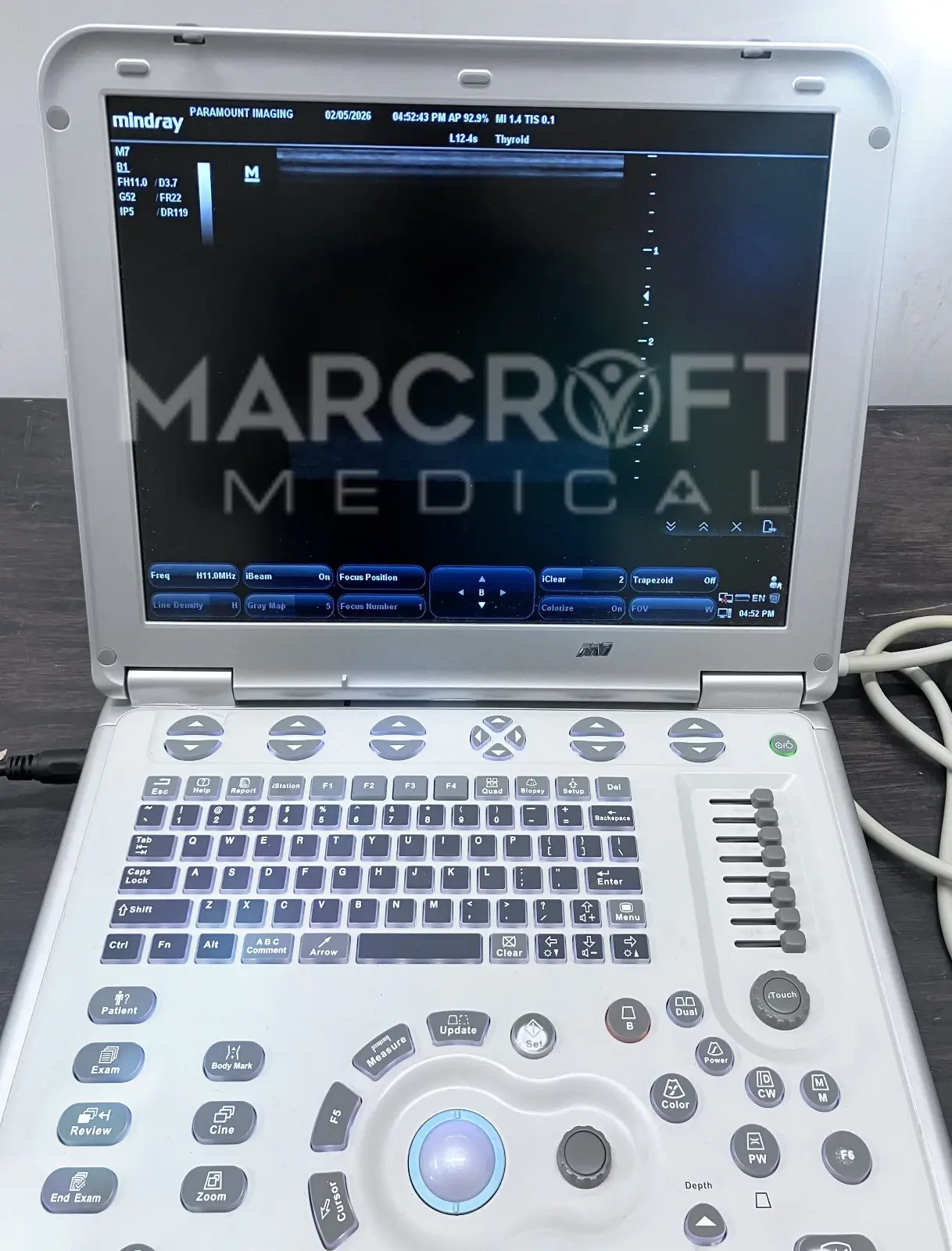 Mindray-M7-Portable-Ultrasound-for-sale-18