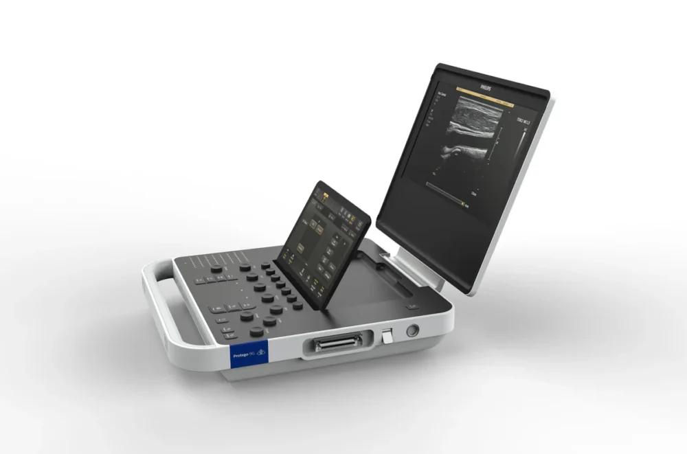 Philips-5500 Philips 5500 Ultrasound