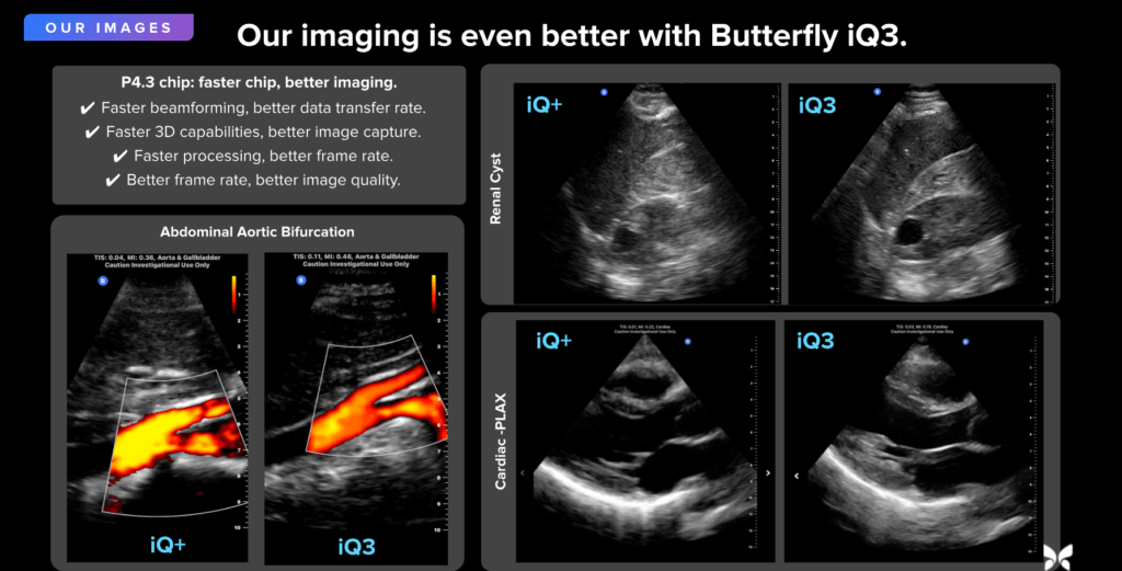 Butterfly iQ3 Handheld Ultrasound | Advanced Portable Imaging