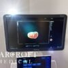 Mindray-DC-70-for-sale-16 Mindray-DC-70-for-sale-16