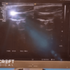 acuson-nx3-for-sale-12 acuson-nx3-for-sale-12