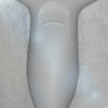 acuson-nx3-for-sale-18 acuson-nx3-for-sale