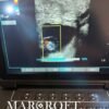 ultrasound-machines-fujifilm-sonosite-px-for-sale-1 fujifilm sonosite px