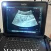 ultrasound-machines-fujifilm-sonosite-px-for-sale-12 sonosite px singapore