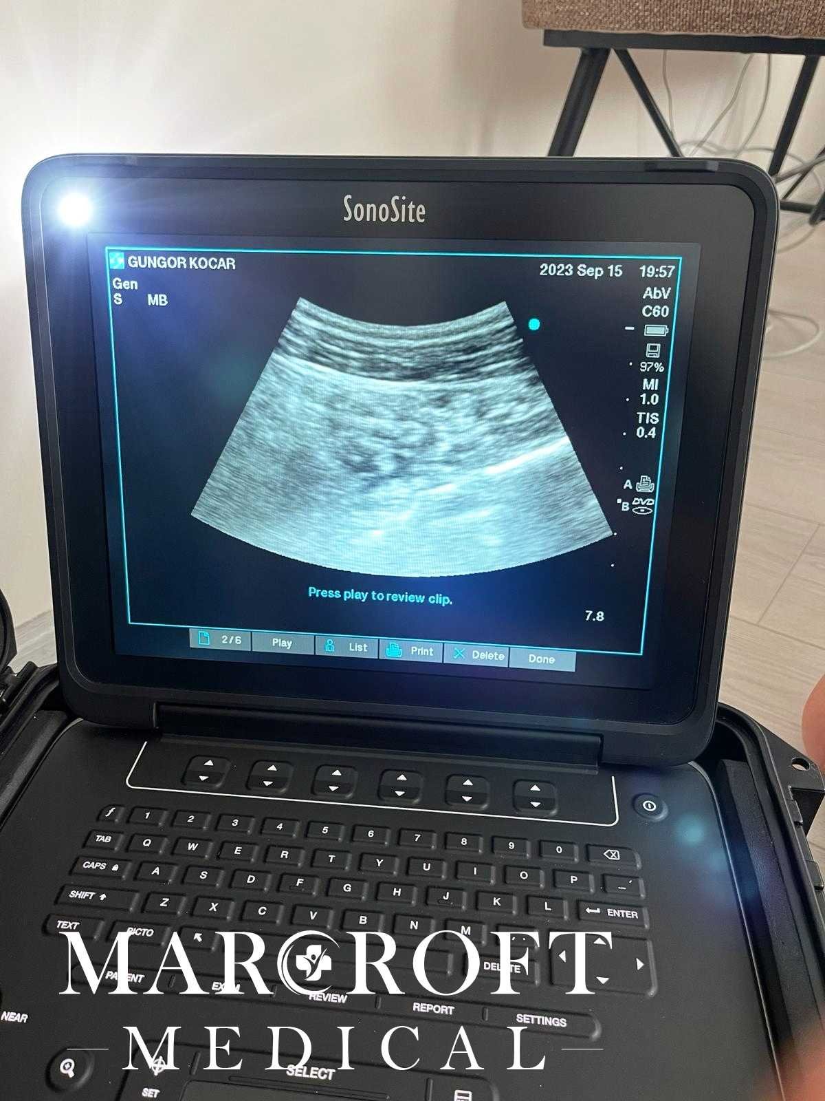 Fujifilm Sonosite PX Ultrasound | Marcroft Medical