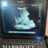 ultrasound-machines-fujifilm-sonosite-px-for-sale-17 buy sonosite px