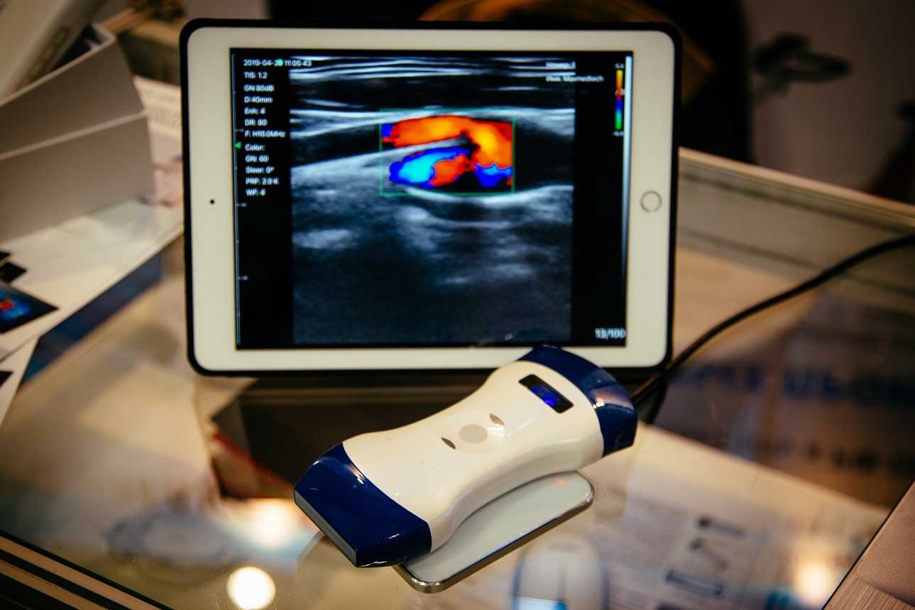 Best Handheld Ultrasound Systems