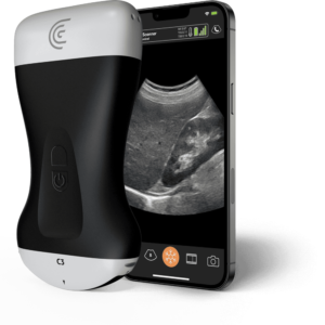Clarius C3 HD3