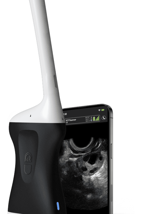 Clarius EC7 HD3 Endocavity Ultrasound Scanner with 3 Year Membership