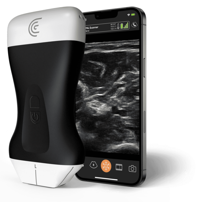 Clarius PAL HD3 Phased + Linear Array Scanner