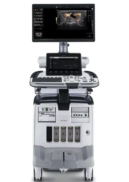 GE LOGIQ E10