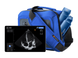Kosmos-Ultraportable-Ultrasound
