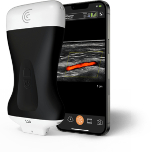-L20-Ultra-High-Freq-Linear-Handheld-Portable-Wireless-Ultrasound-Scanner