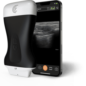 clarius L7 hd3