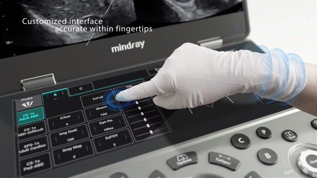 Mindray MX7 customized interface 