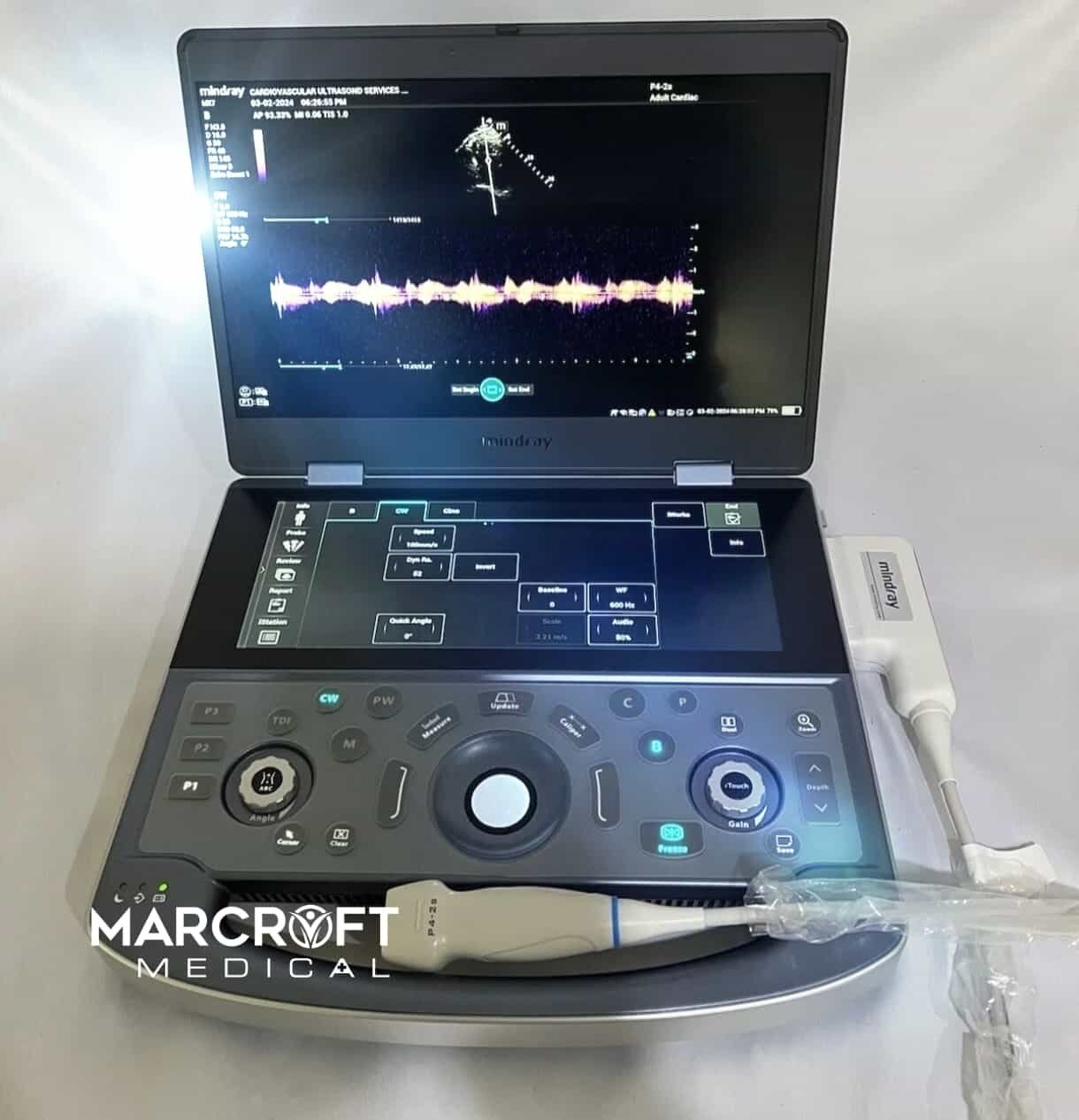 Mindray-MX7-for-sale-1