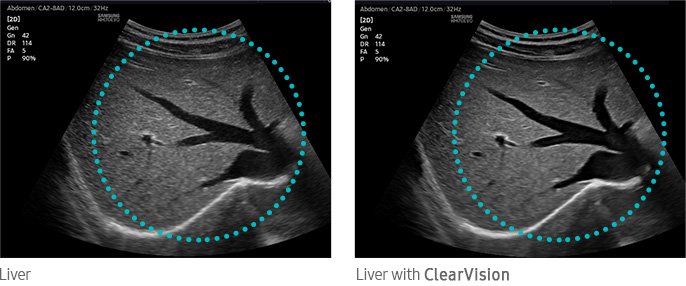 clearvision-img-md