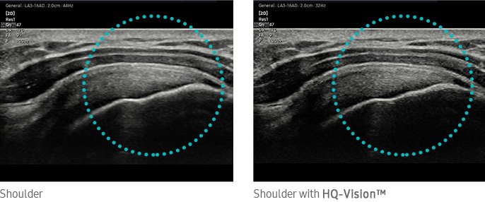 hqvision-img-md
