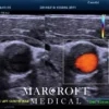 mindray-m8-elite-for-sale-18 mindray-m8-elite-for-sale-18