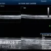 mindray-m8-elite-for-sale-19 mindray-m8-elite-for-sale-19