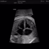 obstetric4chbmodec16d obstetric4chbmodec16d