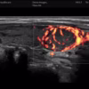 thyroid-touch-panel thyroid-touch-panel