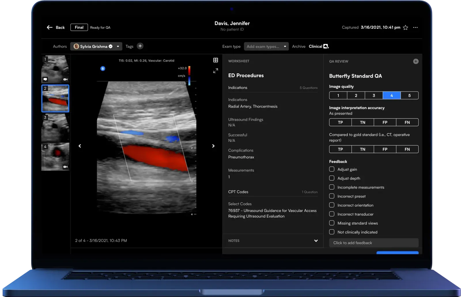 Butterfly Ultrasound Software