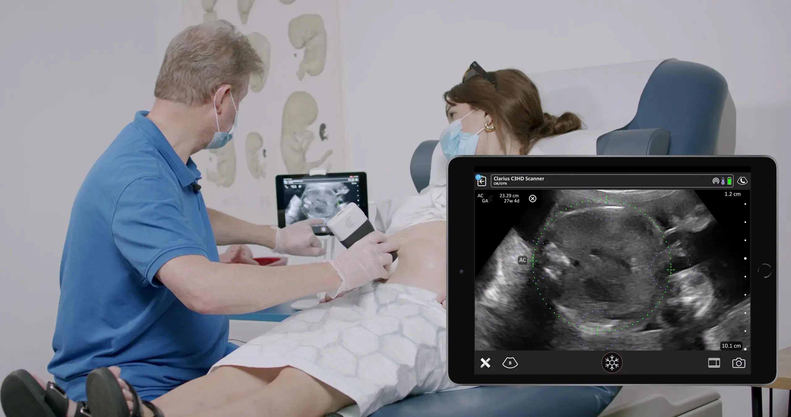 Clarius-Point-of-Care-Imaging