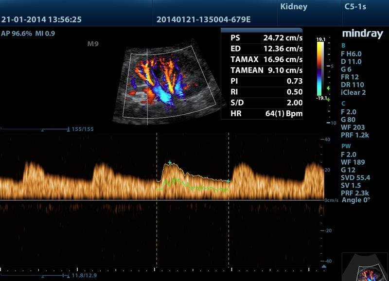 Mindray-M8-Elite-software