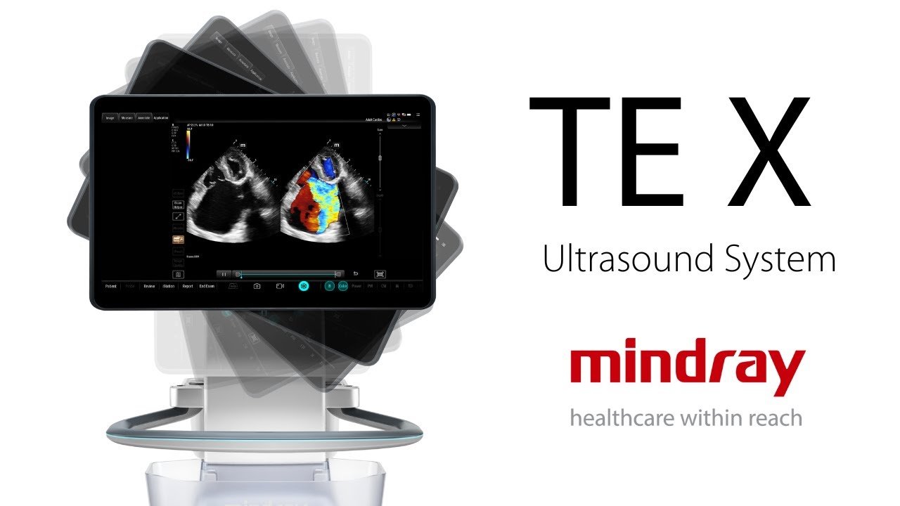 Mindray Ultrasound