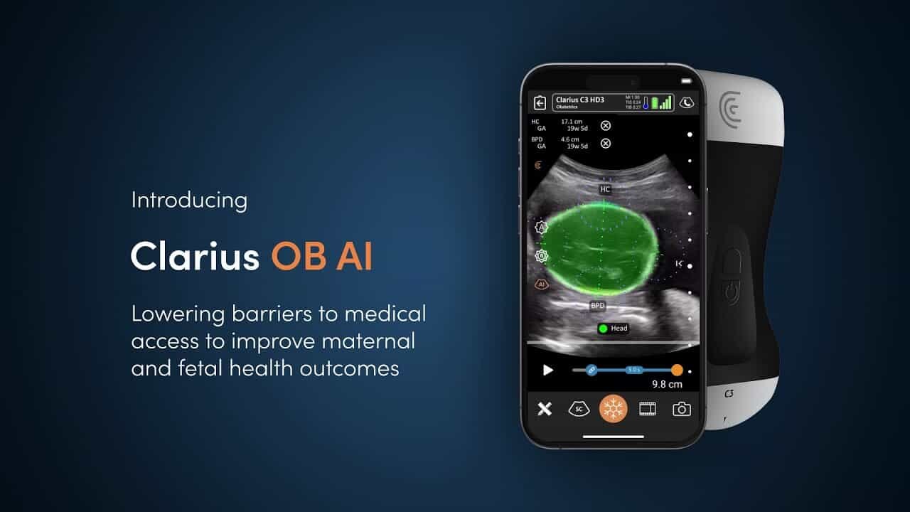 clarius HD3 Series Ob/GYN