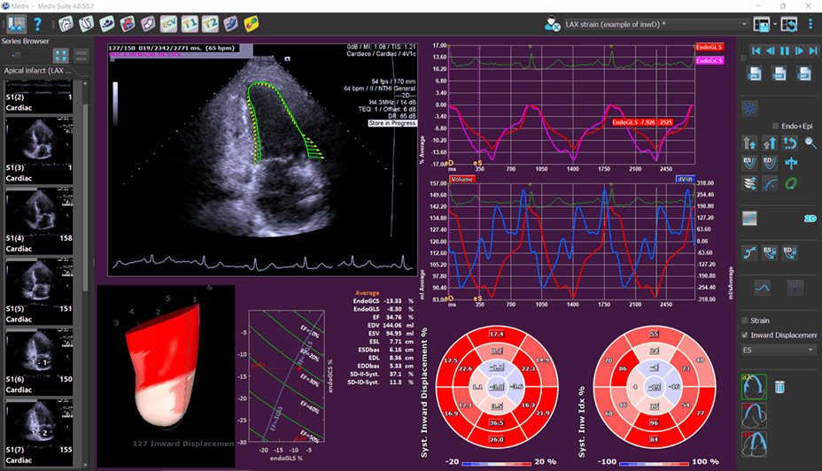 medis-ultrasound-software