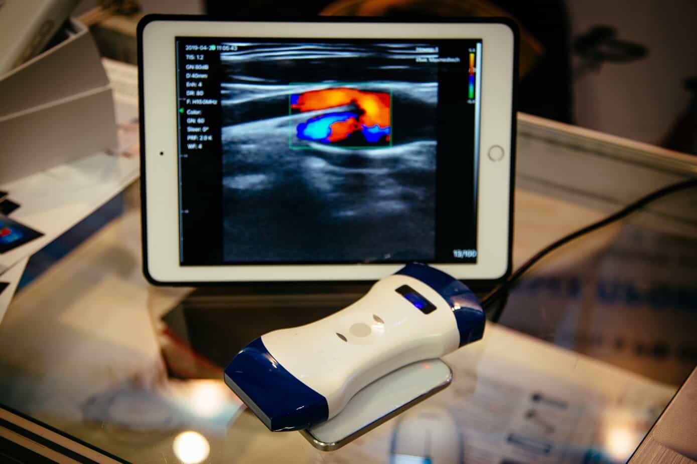 point-of-care ultrasound